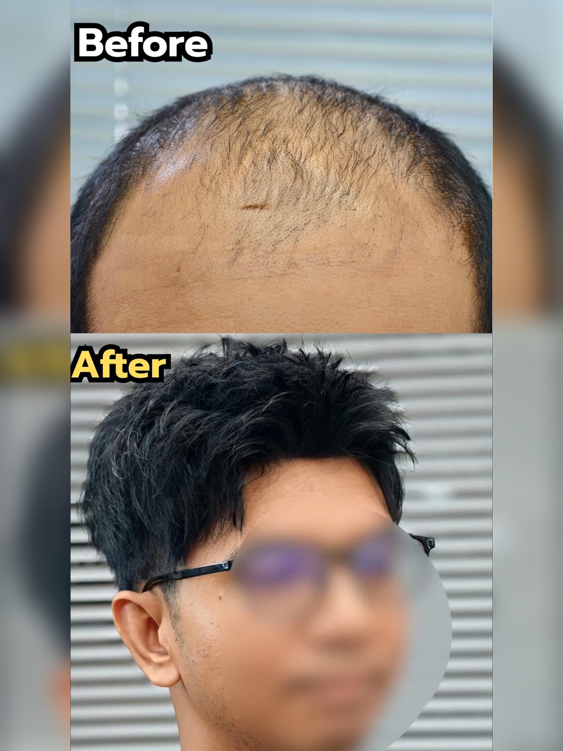 Before