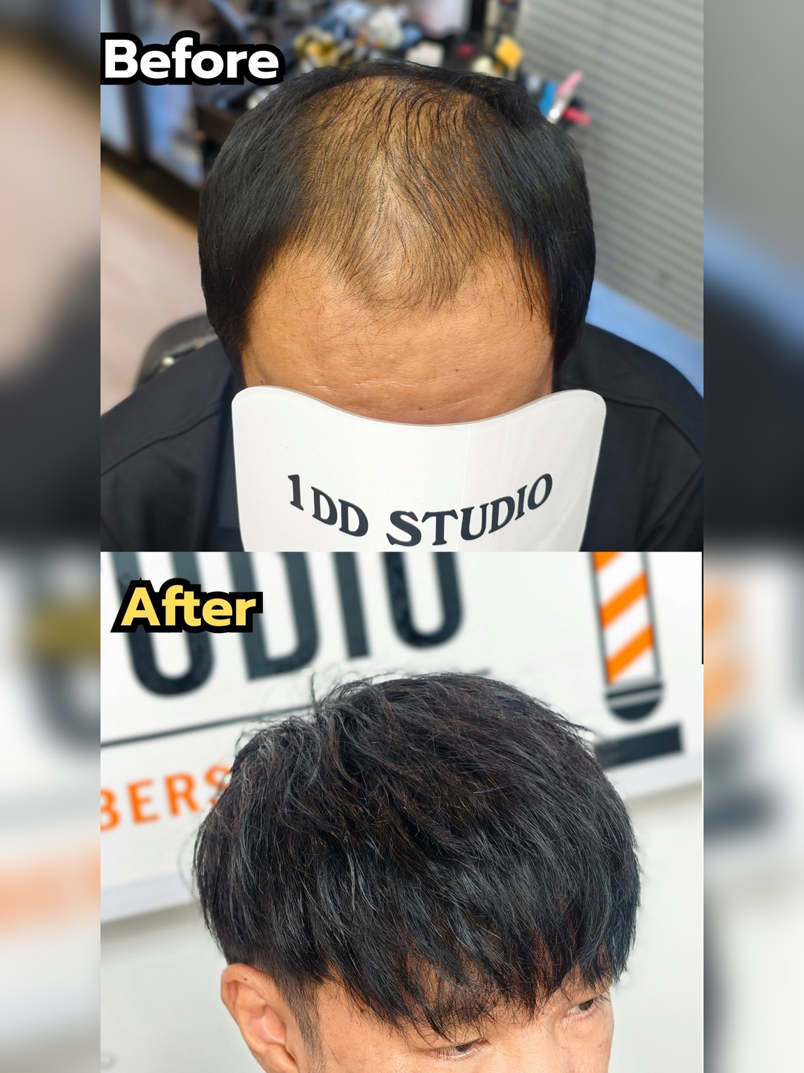 After